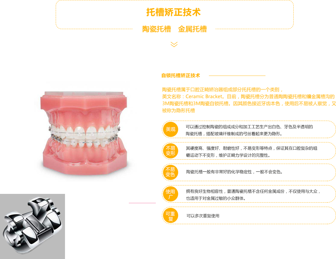 批发牙齿模型 口腔模型 牙齿正畸模型 带托槽正畸牙齿模型-阿里巴巴