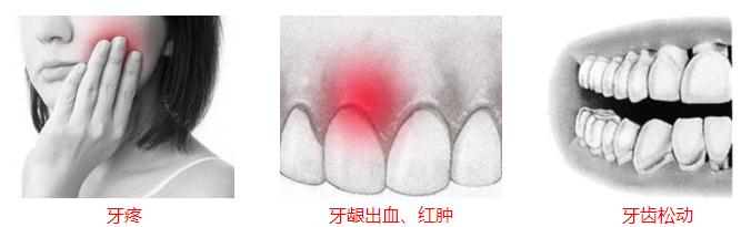 牙周病