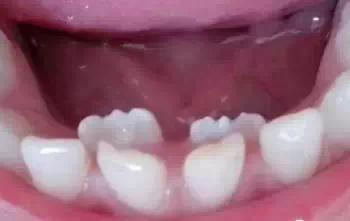 ͯγҪעʲô
