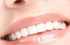 如何选择牙齿美白方法