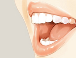成都口腔医院牙齿美白比较好的方法