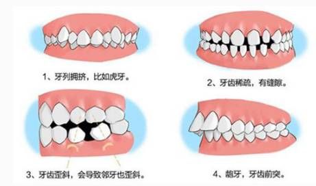 牙齿矫正